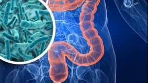 7 normal belflora_304x171.jpg