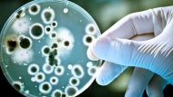 candida_190x107.jpg