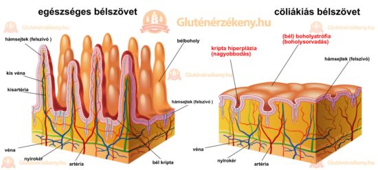 liszterzekenyseg 6.jpg