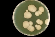 candida gombatelep2_190x130.jpg